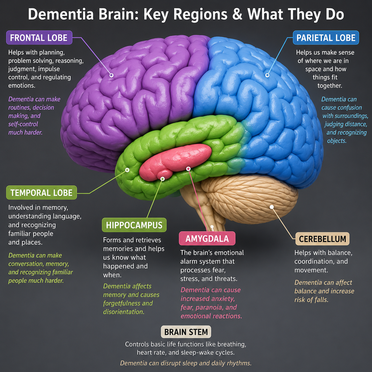 Diagram of the dementia brain showing key regions and their functions: frontal lobe, parietal lobe, temporal lobe, hippocampus, amygdala, cerebellum, and brain stem